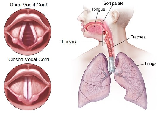 laryngoplasty vocal cords