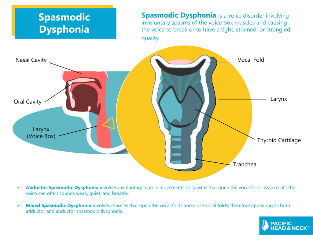 Spasmodic Dysphonia - Pacific Head & Neck