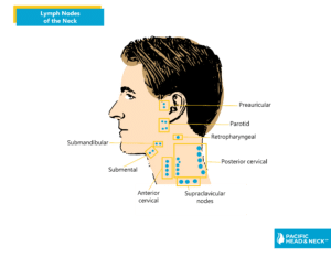 Infographic Lymph Nodes Swollen 1
