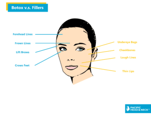 Infographic Botox vs Fillers2