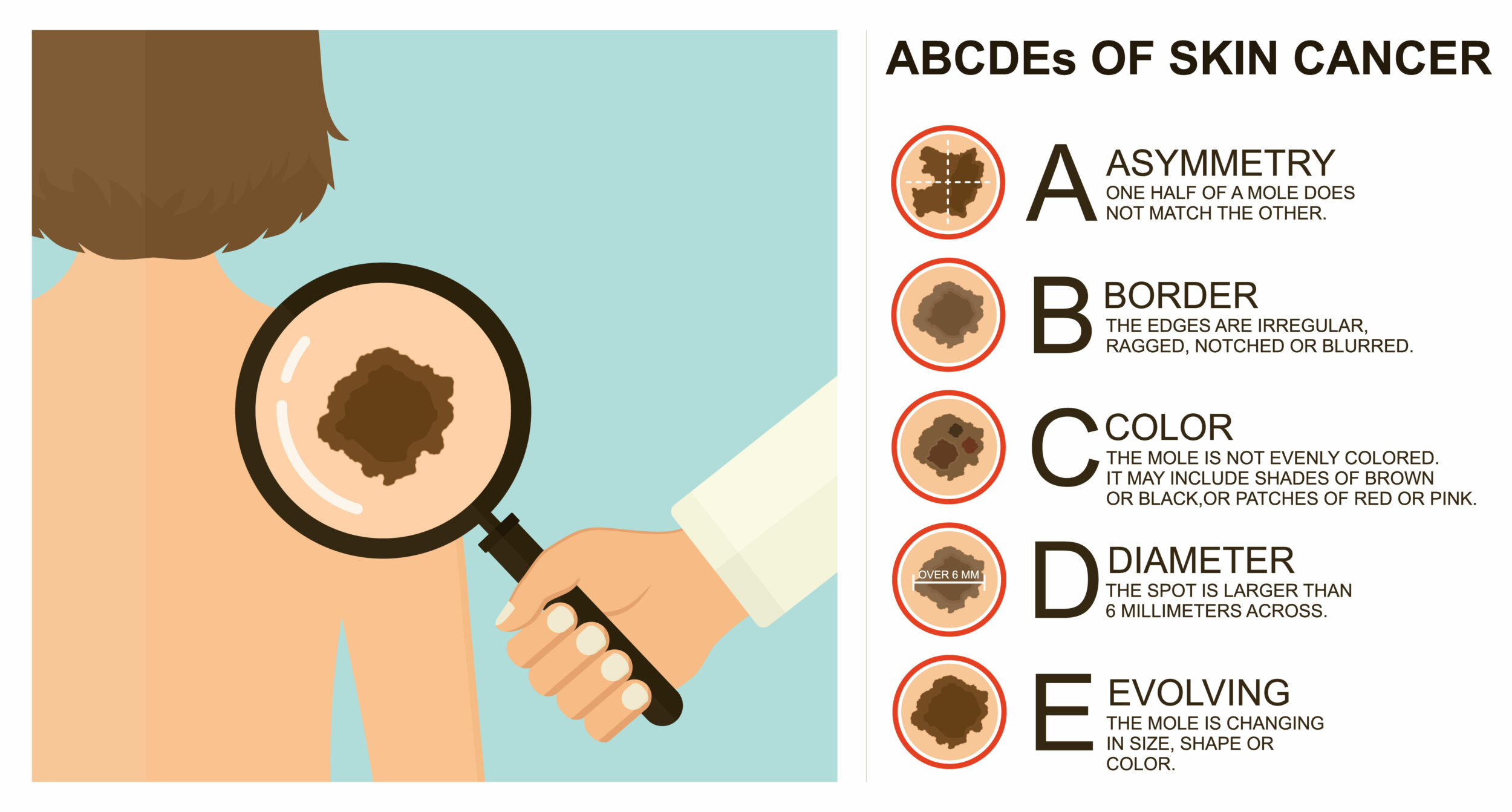 Diagnosis of skin cancer. Melanoma warning signs. Dermatological screening. UVB prevention of squamous cell treatment. Basal test. ABCDEs of skin cancer screening.